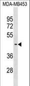 Suppressor Of Variegation 3-9 Homolog 2 antibody, LS-C157115, Lifespan Biosciences, Western Blot image 