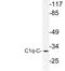 Complement C1q C Chain antibody, LS-C177814, Lifespan Biosciences, Western Blot image 