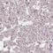 TATA-binding protein-associated factor 2N antibody, HPA052059, Atlas Antibodies, Immunohistochemistry paraffin image 