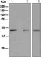 Paired Box 5 antibody, ab109443, Abcam, Western Blot image 