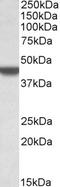 Apolipoprotein B MRNA Editing Enzyme Catalytic Subunit 3D antibody, EB10903, Everest Biotech, Western Blot image 