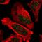 Telomeric Repeat Binding Factor 2 antibody, NBP1-86911, Novus Biologicals, Immunocytochemistry image 