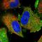 TPD52 Like 1 antibody, PA5-55731, Invitrogen Antibodies, Immunofluorescence image 