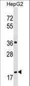 PP2CE antibody, LS-C162075, Lifespan Biosciences, Western Blot image 