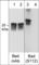 BCL2 Associated Agonist Of Cell Death antibody, BP4971, ECM Biosciences, Western Blot image 