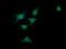 DExD/H-Box Helicase 58 antibody, M00244-1, Boster Biological Technology, Immunofluorescence image 