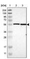 Nuclear Envelope Integral Membrane Protein 1 antibody, PA5-53157, Invitrogen Antibodies, Western Blot image 