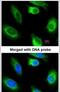 Glycerol Kinase 2 antibody, PA5-21498, Invitrogen Antibodies, Immunofluorescence image 