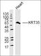 JAZF Zinc Finger 1 antibody, orb184469, Biorbyt, Western Blot image 