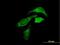 3-Oxoacid CoA-Transferase 1 antibody, H00005019-B01P, Novus Biologicals, Immunofluorescence image 