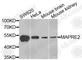 Microtubule Associated Protein RP/EB Family Member 2 antibody, A6649, ABclonal Technology, Western Blot image 