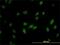 RNA Guanine-7 Methyltransferase antibody, H00008731-M01, Novus Biologicals, Immunofluorescence image 