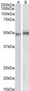 Neutrophil Cytosolic Factor 1 antibody, STJ70023, St John