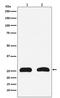High Mobility Group Box 2 antibody, M02651, Boster Biological Technology, Western Blot image 