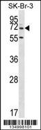 Zinc Finger Protein 398 antibody, 58-045, ProSci, Western Blot image 