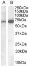 Cell Adhesion Molecule 4 antibody, A09818, Boster Biological Technology, Western Blot image 