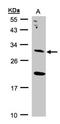 Uroporphyrinogen III Synthase antibody, NBP1-32485, Novus Biologicals, Western Blot image 