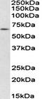 MAPK Activated Protein Kinase 5 antibody, orb107651, Biorbyt, Western Blot image 