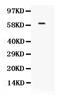 Transcription Factor 7 Like 1 antibody, PB9897, Boster Biological Technology, Western Blot image 