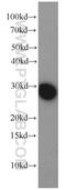 B Cell Receptor Associated Protein 31 antibody, 11200-1-AP, Proteintech Group, Western Blot image 