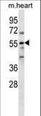 PARP2 antibody, LS-C163372, Lifespan Biosciences, Western Blot image 