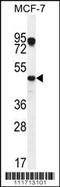 Vascular Endothelial Growth Factor C antibody, 56-135, ProSci, Western Blot image 