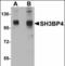 SH3 domain-binding protein 4 antibody, orb89831, Biorbyt, Western Blot image 