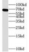 Transcription Factor CP2 antibody, FNab08623, FineTest, Western Blot image 