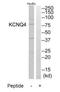 Potassium Voltage-Gated Channel Subfamily Q Member 4 antibody, TA312939, Origene, Western Blot image 