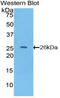 Tissue Factor Pathway Inhibitor 2 antibody, MBS2002243, MyBioSource, Western Blot image 