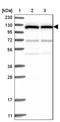 DnaJ Heat Shock Protein Family (Hsp40) Member C6 antibody, NBP1-81507, Novus Biologicals, Western Blot image 