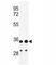 Immunoglobulin Heavy Constant Alpha 1 antibody, F40088-0.4ML, NSJ Bioreagents, Western Blot image 