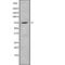 Chloride Voltage-Gated Channel Kb antibody, abx149379, Abbexa, Western Blot image 