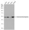 Glutamate Dehydrogenase 1 antibody, GTX105765, GeneTex, Western Blot image 