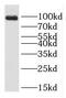 Rho Guanine Nucleotide Exchange Factor 26 antibody, FNab07804, FineTest, Western Blot image 