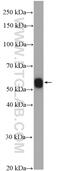 Major Histocompatibility Complex, Class II, DM Alpha antibody, 11838-1-AP, Proteintech Group, Western Blot image 