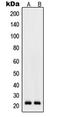 Ras Homolog Family Member D antibody, LS-C353419, Lifespan Biosciences, Western Blot image 