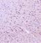 RasGAP-activating-like protein 1 antibody, A06423-2, Boster Biological Technology, Immunohistochemistry paraffin image 