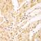 Proteasome 26S Subunit, Non-ATPase 2 antibody, GTX33439, GeneTex, Immunohistochemistry paraffin image 