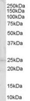 Synaptogyrin-2 antibody, MBS420336, MyBioSource, Western Blot image 