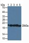 Superoxide Dismutase 2 antibody, LS-C302425, Lifespan Biosciences, Western Blot image 