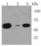 Protein Kinase AMP-Activated Catalytic Subunit Alpha 1 antibody, A00994-5, Boster Biological Technology, Western Blot image 