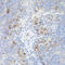 TNF Receptor Superfamily Member 13B antibody, STJ27625, St John