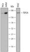 DNA Topoisomerase II Alpha antibody, MAB6540, R&D Systems, Western Blot image 