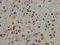 Protein Tyrosine Kinase 2 Beta antibody, LS-C671783, Lifespan Biosciences, Immunohistochemistry paraffin image 