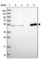 Coiled-Coil Domain Containing 149 antibody, PA5-60634, Invitrogen Antibodies, Western Blot image 