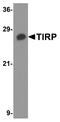 TIR domain-containing adapter molecule 2 antibody, A03965-2, Boster Biological Technology, Western Blot image 