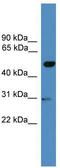 Galactose-3-O-sulfotransferase 3 antibody, TA339639, Origene, Western Blot image 