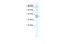 Small conductance calcium-activated potassium channel protein 3 antibody, 28-290, ProSci, Western Blot image 