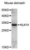 Kallikrein Related Peptidase 14 antibody, abx126061, Abbexa, Western Blot image 